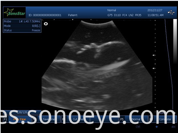 image for labtop ultrasound